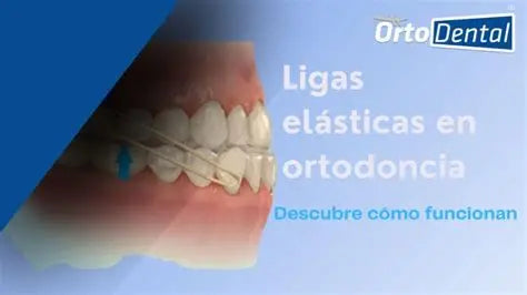 BANDAS ELÁSTICAS 15 CM carpule plasticox100